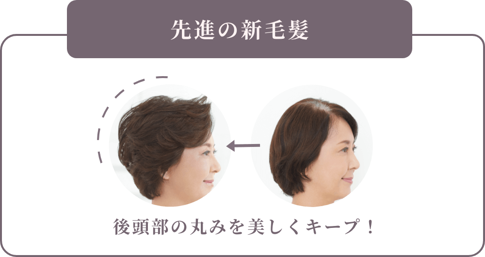 先進の新毛髪