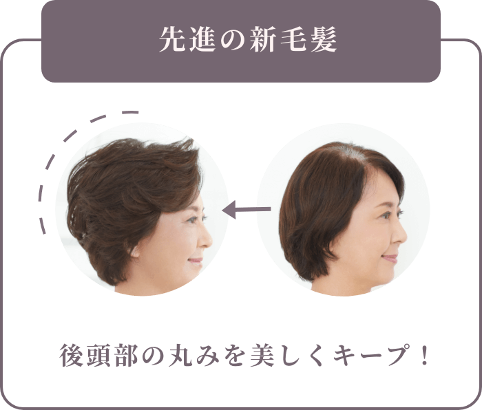 先進の新毛髪